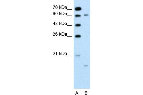 CYP4A22 anticorps  (N-Term)