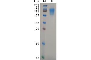 Human CD6 Protein, His Tag on SDS-PAGE under reducing condition. (CD6 Protein (CD6) (AA 18-398) (His tag))