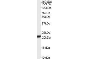 ABIN2564911 (0. (RBP4 anticorps  (Internal Region))