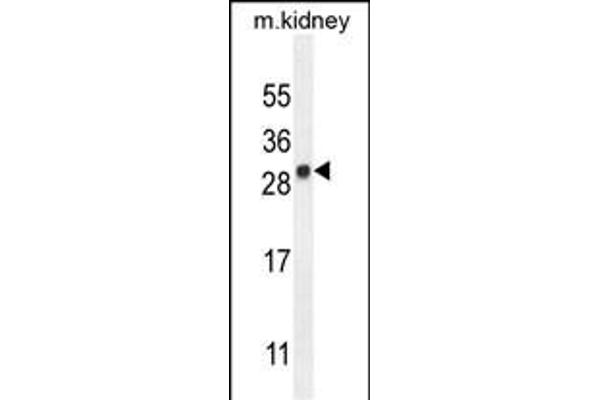 LYPD4 anticorps  (AA 104-133)