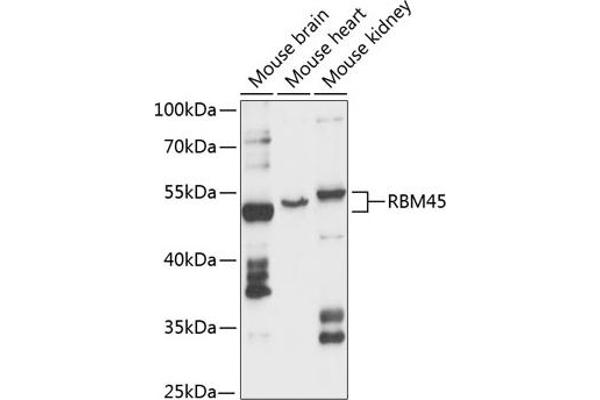 RBM45 anticorps  (AA 1-300)