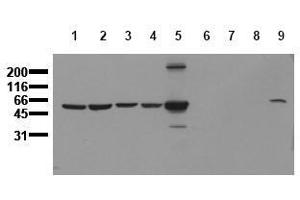 Western Blotting (WB) image for anti-Vimentin (VIM) antibody (ABIN126914) (Vimentin anticorps)