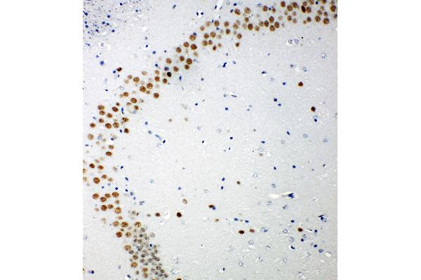 TP53BP1 anticorps  (C-Term)