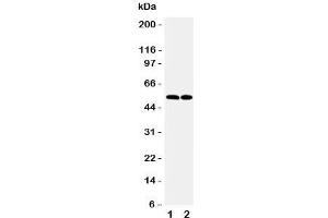 Western blot testing of CCR3 antibody and Lane 1:  K562;  2: Raji cell lysate. (CCR3 anticorps  (N-Term))