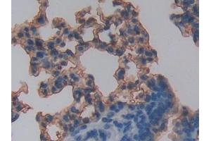 DAB staining on IHC-P; Samples: Mouse Lung Tissue (RAGE anticorps  (AA 10-188))