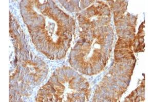 Immunohistochemistry (IHC) image for anti-Tumor Necrosis Factor (Ligand) Superfamily, Member 15 (TNFSF15) antibody (ABIN5708012)