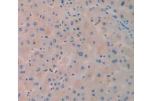 IHC-P analysis of Human Tissue, with DAB staining. (PCK1 anticorps  (AA 311-558))