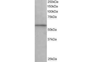 Western Blotting (WB) image for anti-Karyopherin alpha 3 (Importin alpha 4) (KPNA3) antibody (ABIN5921579) (KPNA3 anticorps)