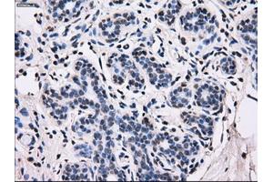 Immunohistochemical staining of paraffin-embedded breast tissue using anti-ID3 mouse monoclonal antibody. (ID3 anticorps)
