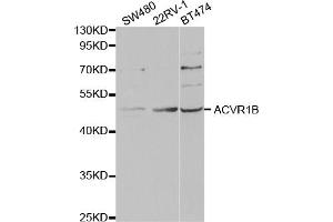 Western blot analysis of extracts of various cell lines, using ACVR1B antibody. (Activin A Receptor Type IB/ALK-4 anticorps)