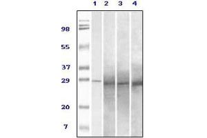 Western Blotting (WB) image for anti-RAB25, Member RAS Oncogene Family (RAB25) antibody (ABIN1844336) (RAB25 anticorps)