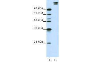 WB Suggested Anti-SF3B1 Antibody Titration:  0. (SF3B1 anticorps  (N-Term))