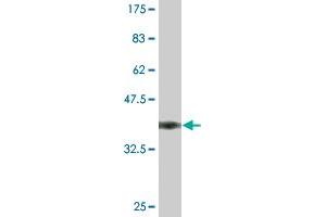 Western Blot detection against Immunogen (36. (ENOS anticorps  (AA 61-160))