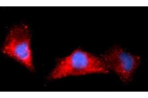 Immunofluorescence (IF) image for anti-Aldehyde Dehydrogenase 1 Family, Member A1 (ALDH1A1) (AA 1-501) antibody (APC) (ABIN5568626) (ALDH1A1 anticorps  (AA 1-501) (APC))