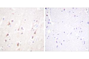 Peptide - +Immunohistochemistry analysis of paraffin-embedded human brain tissue using IRS-1 antibody. (IRS1 anticorps)