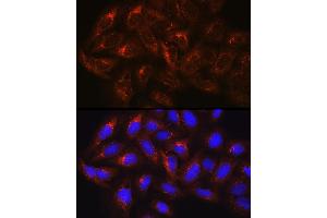 Immunofluorescence analysis of U-2 OS cells using HGS Rabbit pAb (ABIN6131749, ABIN6141748, ABIN6141749 and ABIN6218898) at dilution of 100 (40x lens). (HGS anticorps  (AA 548-777))