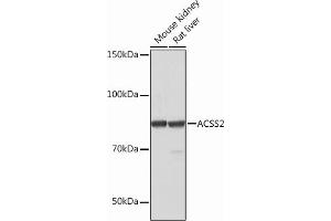 Western blot analysis of extracts of various cell lines, using  Rabbit mAb (ABIN7265427) at 1:1000 dilution. (ACSS2 anticorps)