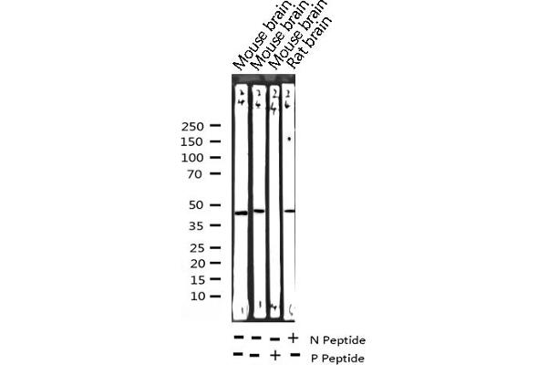 CEBPA anticorps  (pSer21)