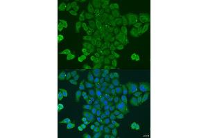 Immunofluorescence analysis of U2OS cells using DPM1 antibody (ABIN2736653) at dilution of 1:100. (DPM1 anticorps)