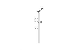 Western Blot at 1:1000 dilution + Ramos whole cell lysates Lysates/proteins at 20 ug per lane. (Musculin anticorps  (C-Term))