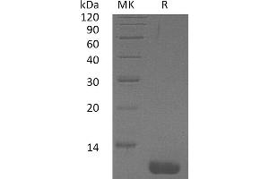 Greater than 95 % as determined by reducing SDS-PAGE. (CCL1 Protéine)