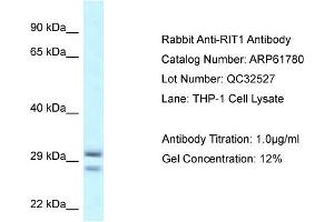 Western Blotting (WB) image for anti-Ras-Like Without CAAX 1 (RIT1) (Middle Region) antibody (ABIN786493) (RIT1 anticorps  (Middle Region))