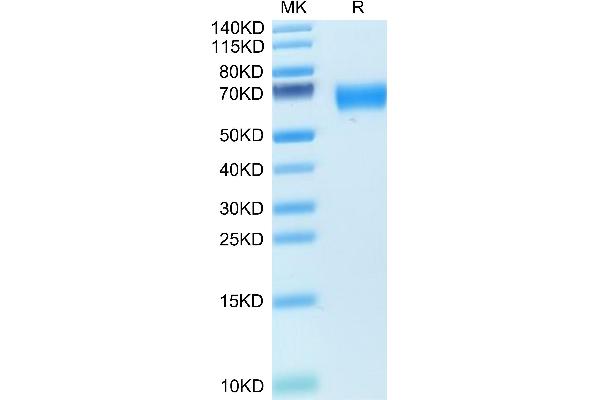 AMIGO2 Protein (AA 40-398) (His tag)