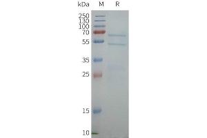 SDS-PAGE (SDS) image for ATP-Binding Cassette, Sub-Family G (WHITE), Member 1 (ABCG1) protein (ABIN7538140)