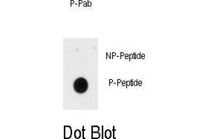 Image no. 1 for anti-Insulin Receptor (INSR) (pTyr1185) antibody (ABIN358482) (Insulin Receptor anticorps  (pTyr1185))