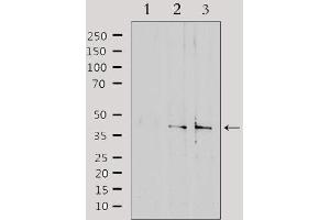 SLC15A1 anticorps  (Internal Region)