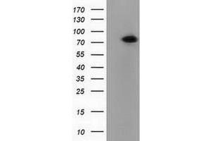 Western Blotting (WB) image for anti-Pseudouridylate Synthase 7 Homolog (PUS7) antibody (ABIN1500516) (PUS7 anticorps)