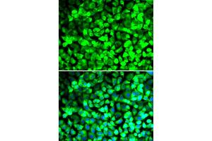 Immunofluorescence analysis of U2OS cells using EIF5 antibody. (EIF5 anticorps)