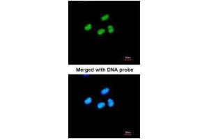ICC/IF Image Immunofluorescence analysis of paraformaldehyde-fixed HeLa, using ATRX, antibody at 1:200 dilution. (ATRX anticorps  (C-Term))