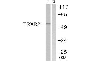 Western blot analysis of extracts from HT29 cells, using TRXR2 antibody. (TXNRD2 anticorps  (C-Term))