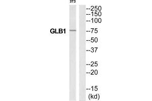 Western Blotting (WB) image for anti-Galactosidase, beta 1 (GLB1) (Internal Region) antibody (ABIN1850915) (GLB1 anticorps  (Internal Region))
