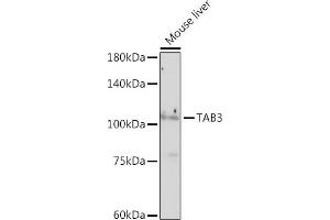 Western blot analysis of extracts of Mouse liver, using T antibody (ABIN7270793) at 1:1000 dilution. (TAB3 anticorps)