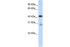 Western Blotting (WB) image for anti-GRAM Domain Containing 2 (GRAMD2) antibody (ABIN2458873) (GRAMD2 anticorps)