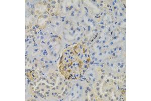 Immunohistochemistry of paraffin-embedded rat kidney using FLT3 antibody. (FLT3 anticorps)