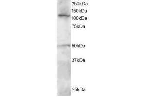 Image no. 1 for anti-Helicase-Like Transcription Factor (HLTF) (C-Term) antibody (ABIN374218) (HLTF anticorps  (C-Term))