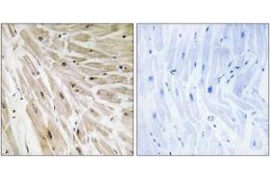 Immunohistochemistry (IHC) image for anti-Ribosomal Protein L22 (RPL22) (AA 51-100) antibody (ABIN2890073) (RPL22 anticorps  (AA 51-100))