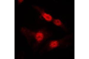 Immunofluorescent analysis of DGK alpha staining in MDCK cells. (DGKA anticorps  (Center))