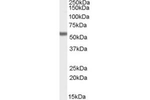 Western Blotting (WB) image for anti-Forkhead Box C1 (FOXC1) (C-Term) antibody (ABIN2465707) (FOXC1 anticorps  (C-Term))
