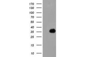 HEK293T cells were transfected with the pCMV6-ENTRY control (Left lane) or pCMV6-ENTRY FAM84B (Right lane) cDNA for 48 hrs and lysed. (FAM84B anticorps)