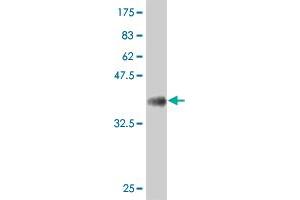 Western Blotting (WB) image for anti-SRY (Sex Determining Region Y)-Box 9 (SOX9) (AA 400-509) antibody (ABIN520382)