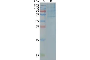 Human -Nanodisc, Flag Tag on SDS-PAGE (CCR4 Protéine)