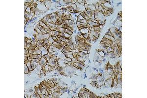 Immunohistochemistry of paraffin-embedded human stomach using CLDN3 antibody (ABIN5971516) (40x lens). (Claudin 3 anticorps)