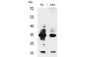 Western Blot analysis of Raji, Jurkat cells using IL-4 Polyclonal Antibody. (IL-4 anticorps  (Internal Region))