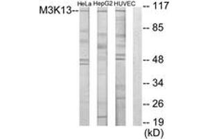 Western Blotting (WB) image for anti-Mitogen-Activated Protein Kinase Kinase Kinase 13 (MAP3K13) (AA 151-200) antibody (ABIN2889320) (MAP3K13 anticorps  (AA 151-200))