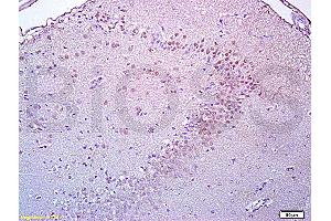 Formalin-fixed and paraffin embedded rat brain tissue labeled with Anti-Brdu Polyclonal Antibody, Unconjugated (ABIN729808) at 1:200, followed by conjugation to the secondary antibody and DAB staining (BrdU anticorps)