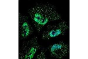 Confocal immunofluorescent analysis of HuR antibody with NCI-H460 cells followed by Alexa Fluor 488-conjugated goat anti-mouse lgG (green). (ELAVL1 anticorps)